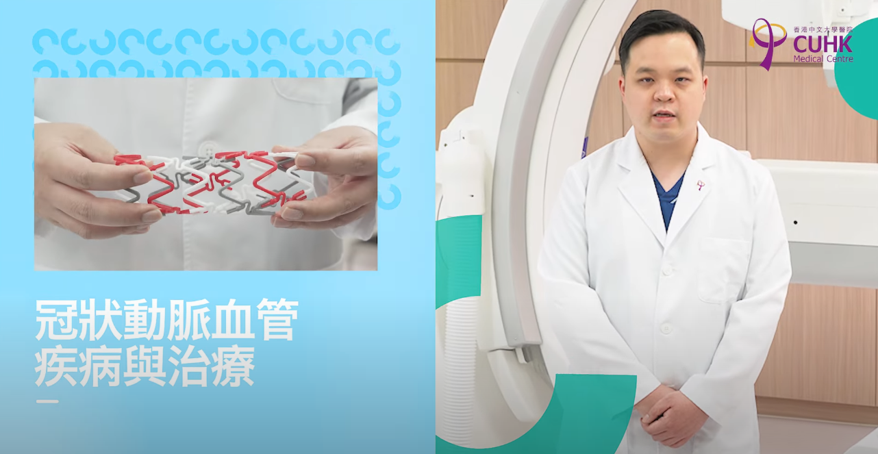 Coronary Artery Disease and Treatments